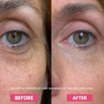 Luxe Korean Under Eye Balm – Lift & Firm 3-in-1 Multi Balm Stick, Hydrating, Smoothing, and Refreshing Eye Care for Dark Circles, Puffiness, and Fine Lines, with PDRN Collagen Extract - Image 5